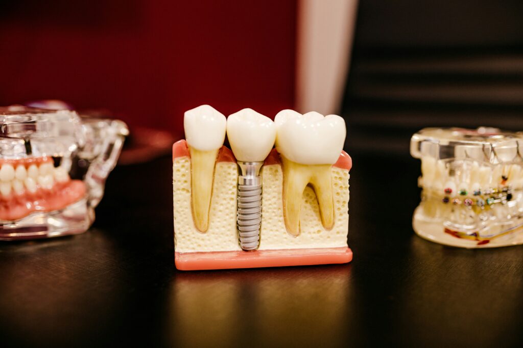 Teeth Problems